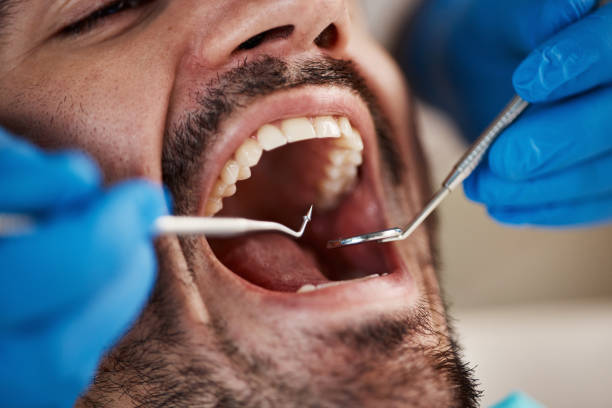 Best Tooth Extraction  in Trafalgar, IN